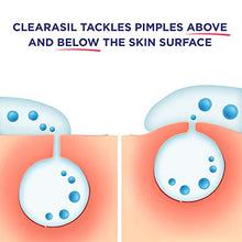Load image into Gallery viewer, Clearasil Daily Clear Tinted Acne Treatment Cream, 1 oz. (Pack of 2)